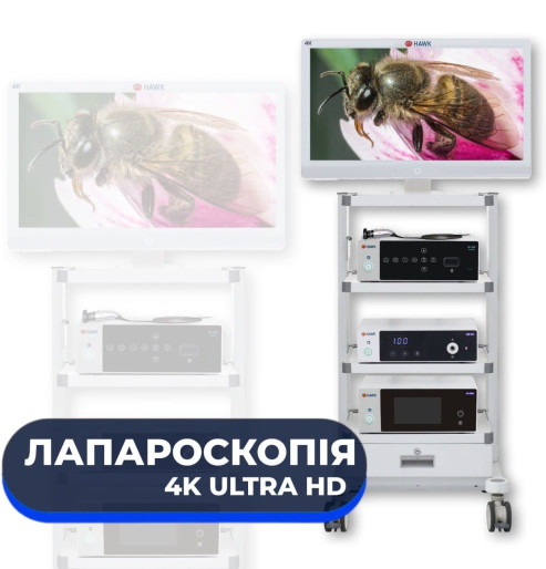 Лапароскопічна стійка 4K для малоінвазивних операцій